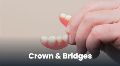 Dental crowns and bridges in Punawale, Pune
