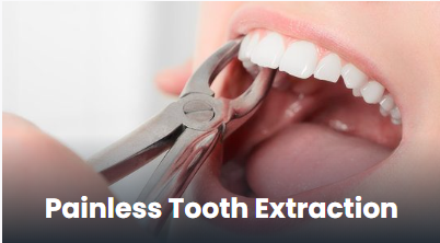 Painless tooth extraction in Punawale, Pune