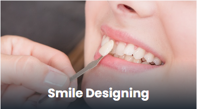 Smile designing and veneers in Punawale, Pune